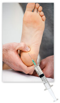 De alternatieve behandelingen van hielspoor - Injecties De alternatieve behandelingen van hielspoor - Injecties